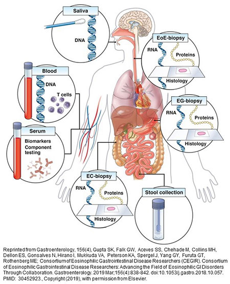 Eosinophilic Gastrointestinal Disorders Rothenberg Laboratory Current Projects 7634